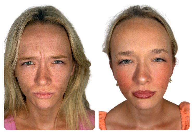 TOX Before-After 1
